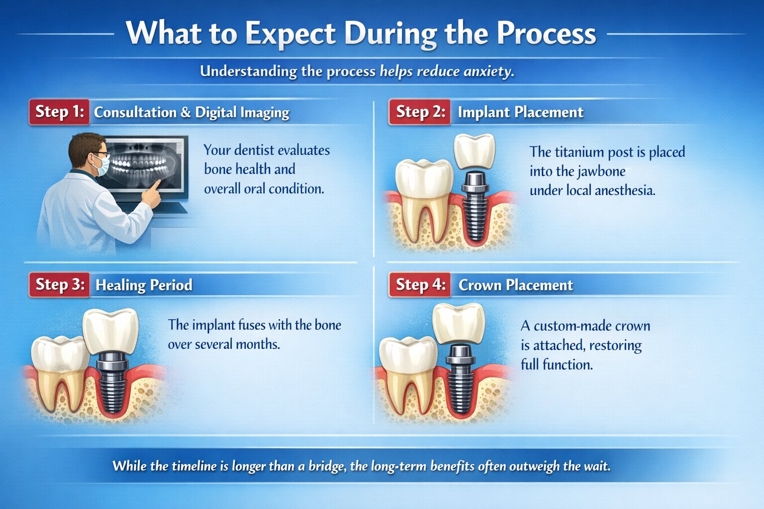 What to Expect During the Process