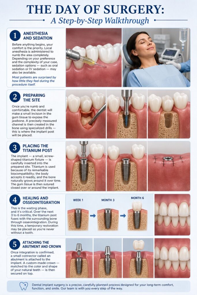The Day of Surgery A Step by Step Walkthrough